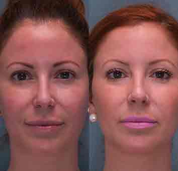 before-after2